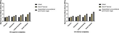 Biomechanical performance of the novel assembled uncovertebral joint fusion cage in single-level anterior cervical discectomy and fusion: A finite element analysis